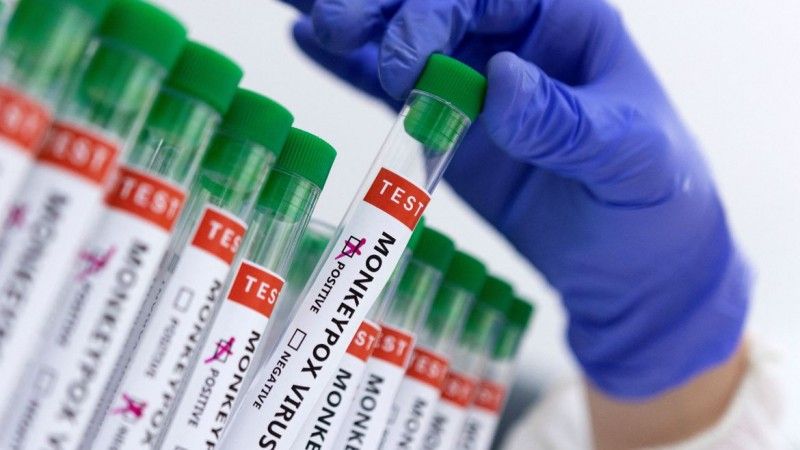 Secretaria Estadual da Saúde confirma primeiro caso da varíola do macaco no RS