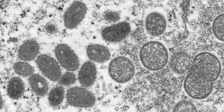 Confirmado quarto caso de varíola dos macacos no Rio Grande do Sul 