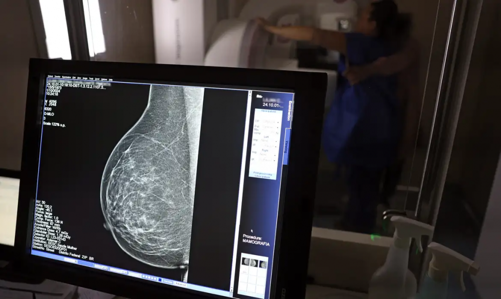 Câncer de mama: uma em cada três pacientes tem menos de 50 anos