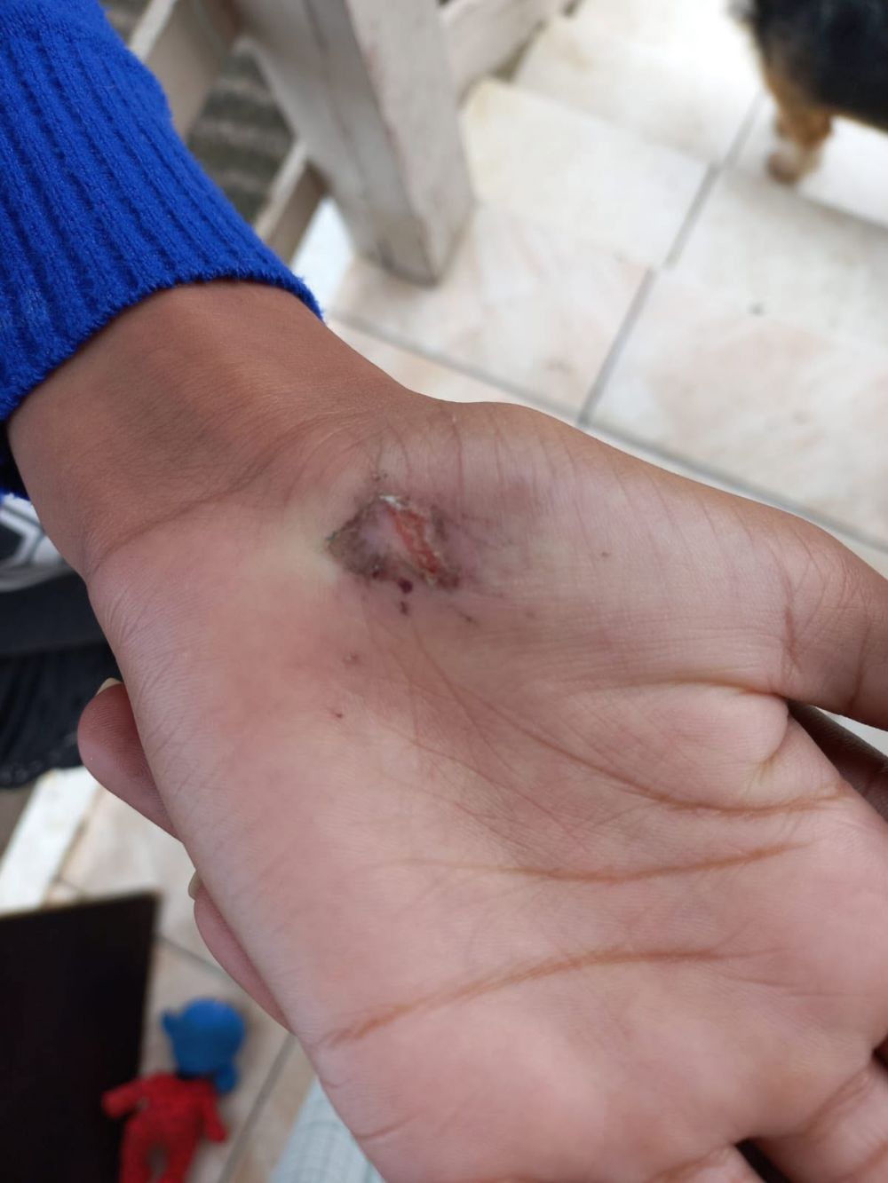 Cães atacam crianças, deixam feridos e revoltam moradores no bairro Fenachamp