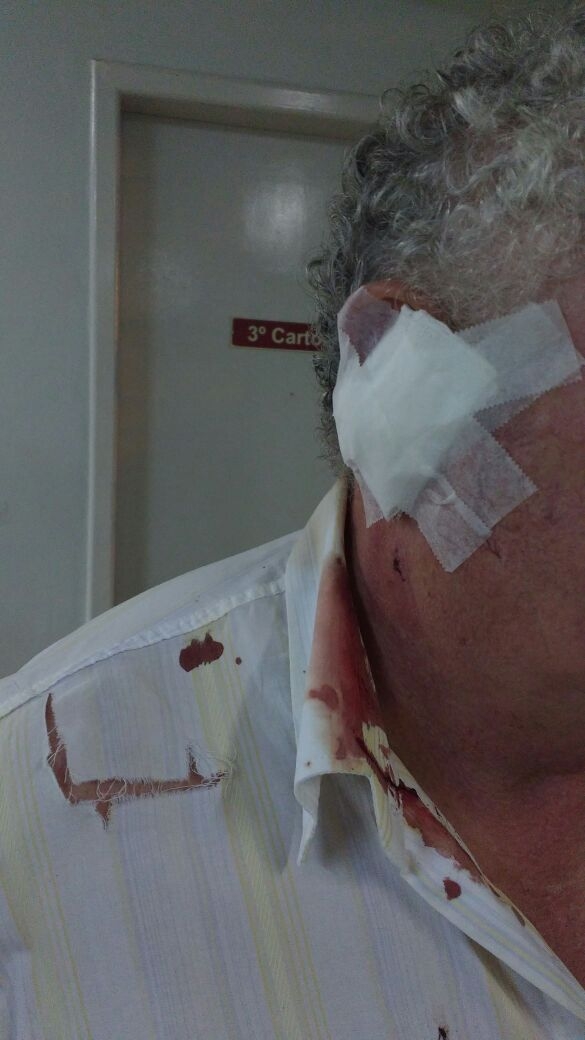 Taxista é assaltado e ferido por marginais próximo a RSC- 453  em Garibaldi